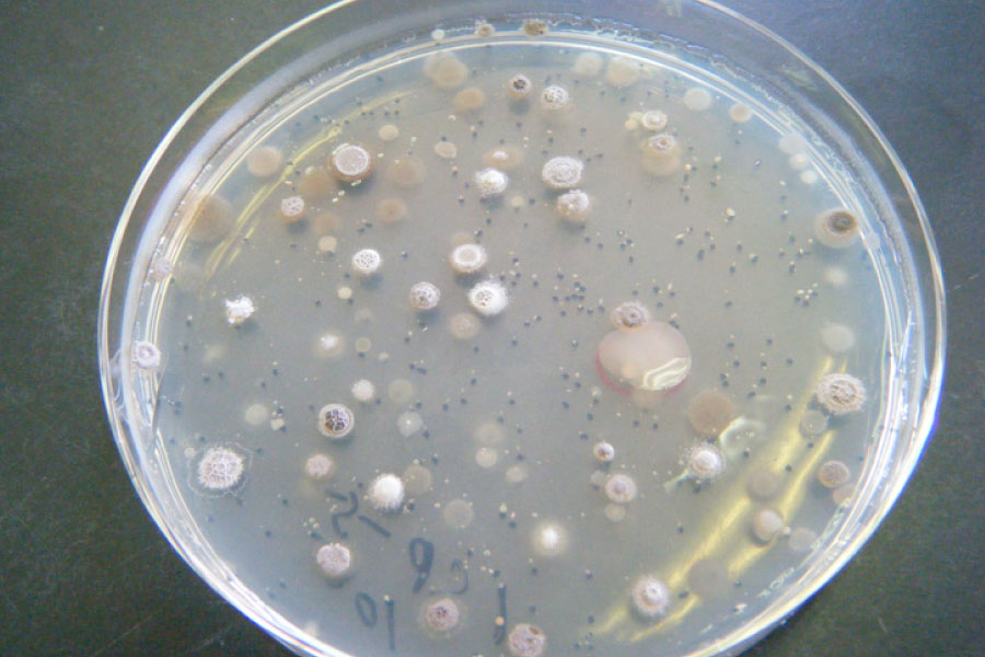 微生物相調査 シャーレ内